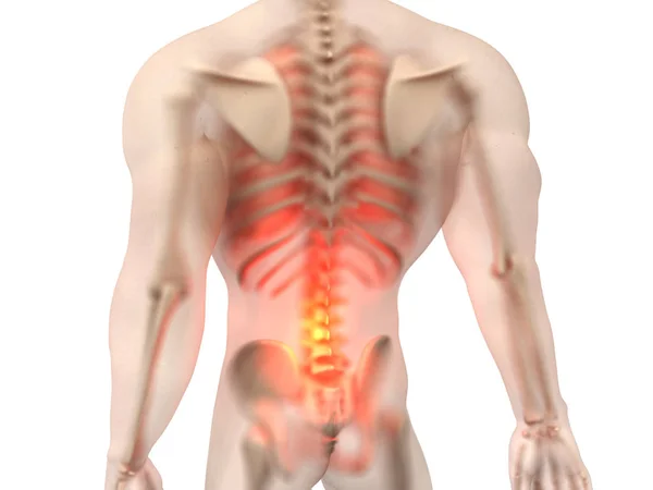 男性解剖-背痛 — 图库照片